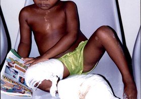PEDIATRIA DO HU